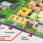 Fakultní nemocnice Ostrava hlásí S.O.S. Zásoby krve jsou na minimu